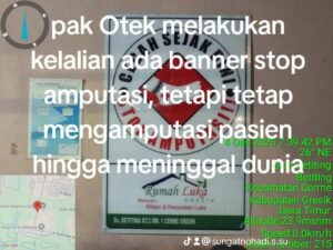 Rumah Luka milik Otek sudah terpasang “Stop Amputasi” Jari Pasien tetap Diamputasi mengakibatkan infeksi dan meninggal dunia